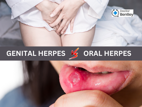 What is Herpes? Genital Herpes VS Oral Herpes